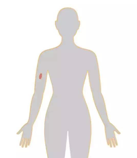 20个癌症的真实案例,13种癌症最新研究报告