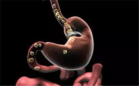 快来看看，和你息息相关的防癌知识！