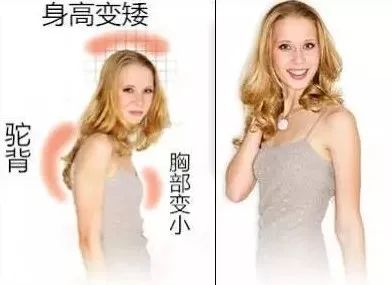 防驼背矫正神器步骤,纠正驼背神器视频