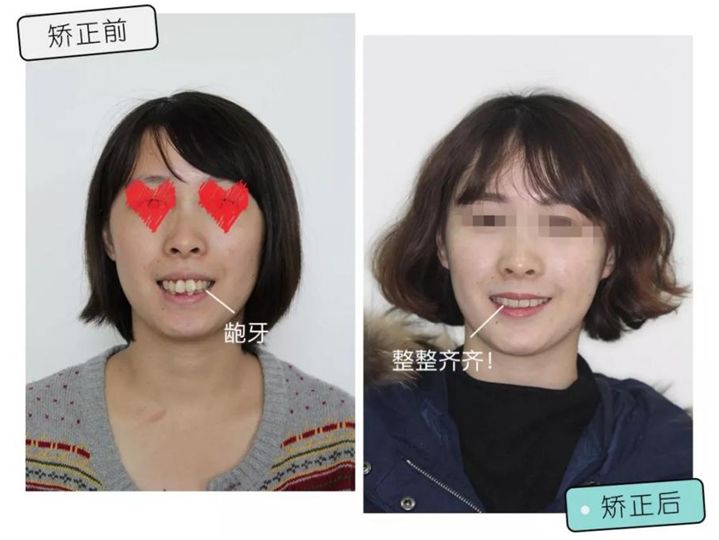 速看！11月起，这些新规实施，矫正牙齿、种植牙这些费用全免！