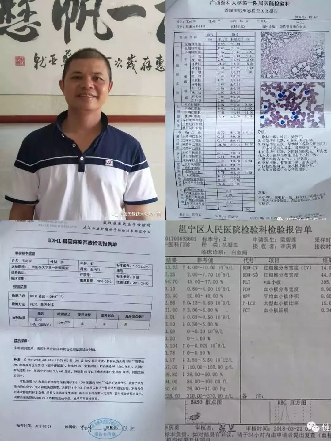 在美国用最贵的药，咏哥还是走了，世间有没有赶走癌症的药？