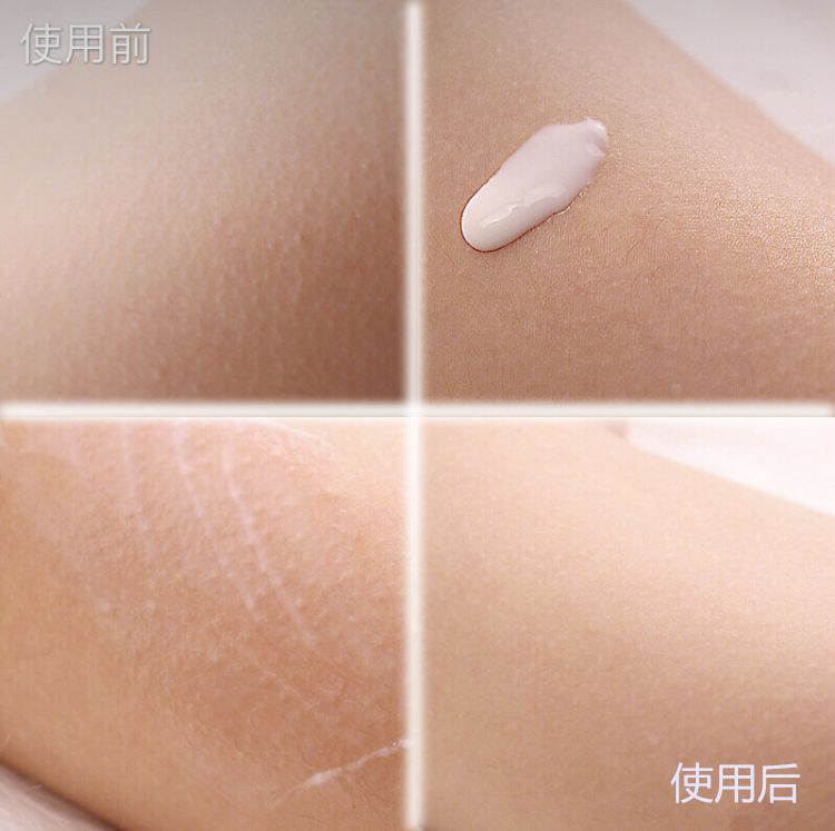 肩颈病用什么贴膏效果好,肩颈疼痛用日本什么膏药好