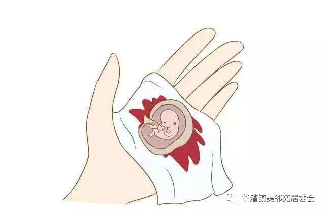 人工流产后需要避孕吗,什么是人工流产后的一线避孕方法