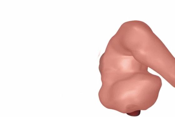 便秘是怎么回事能看好吗,便秘的表现与症状怎么解决