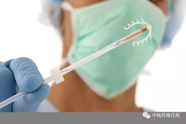 女性避孕技术,医学最安全最有效的避孕方式