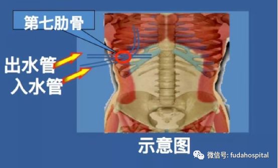 热水烫死癌细胞的危害,热水烫死癌细胞