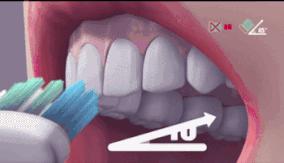 为什么怎么都刷不干净牙,刷了这么多年牙
