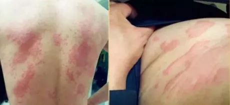 清凉止痒防暑醒神膏,止痒的草药膏