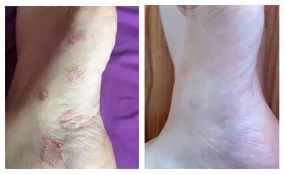 清凉止痒防暑醒神膏,止痒的草药膏