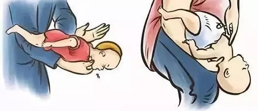 气道被异物阻塞怎么办,噎住是气道梗阻吗