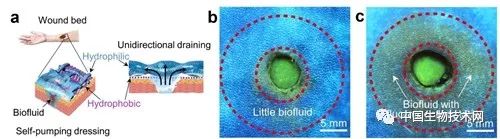 理化所亲疏水复合敷料用于促进伤口愈合研究获进展