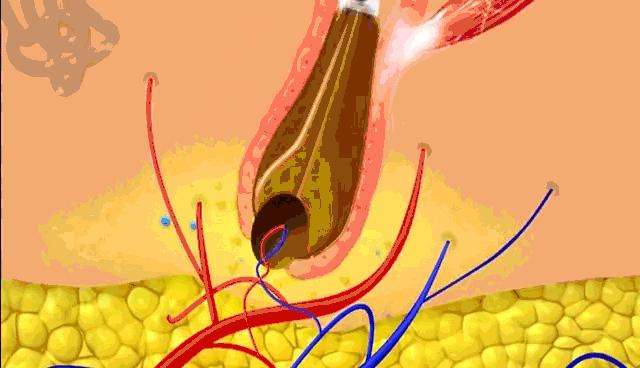 头上的螨虫用什么方法消除,头上又油又痒