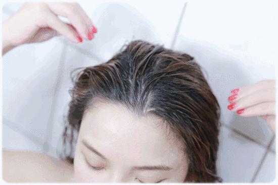 头上头皮屑和剪发虫怎么解决,头皮屑多且大块还结痂会不会有虫