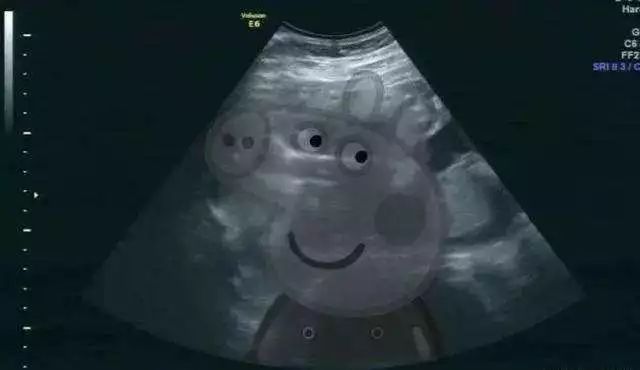 2020年分娩高峰,今年生育高峰