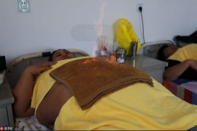 权健火疗专治疑难杂症,权健火疗有什么作用