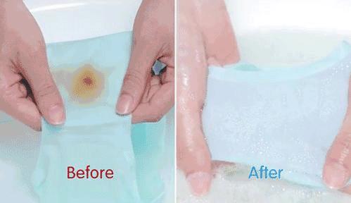 内裤变脏黄黑是什么病,裤子上有黄黄的东西是怎么回事