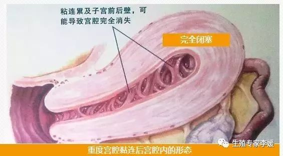 闭经如何治疗最好,闭经的中医治疗