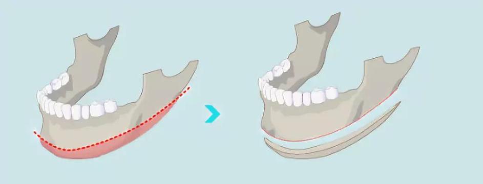 整容毁容真实案例如何赔偿,315整容机构后续