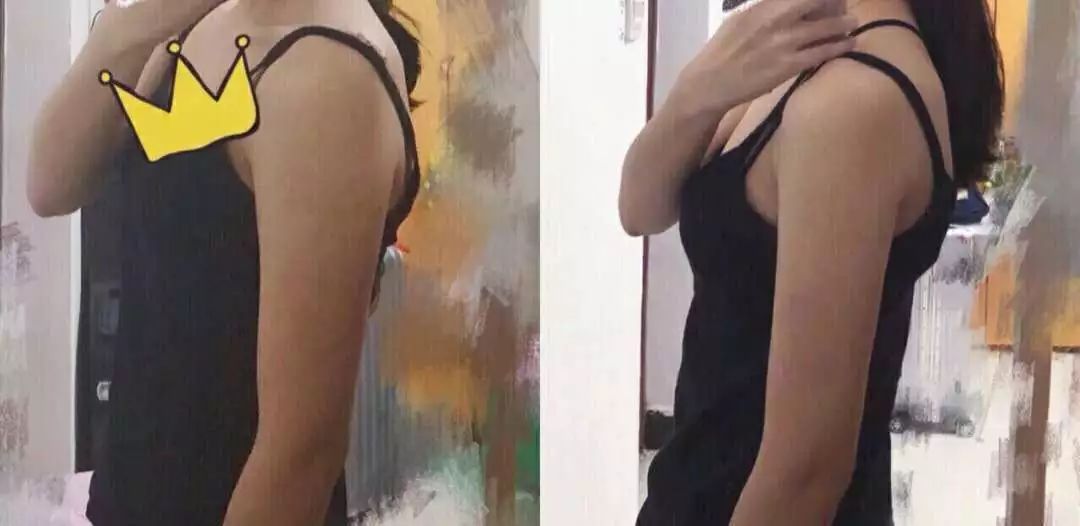 同样是减肥你为什么瘦不下来,同样是减肥为什么你减肥那么慢