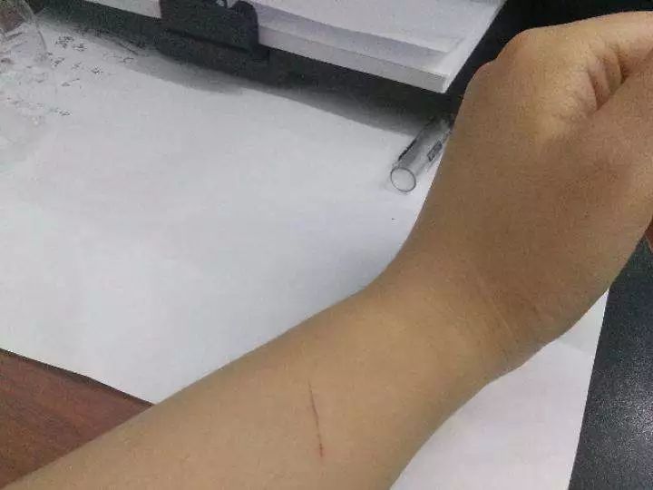 跟狗狗亲密接触会不会得病,狗狗互相玩耍会感染狂犬病吗