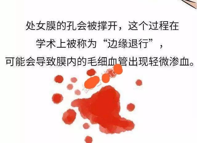 「女科荟」大部分人都错了——处女膜其实不是膜！