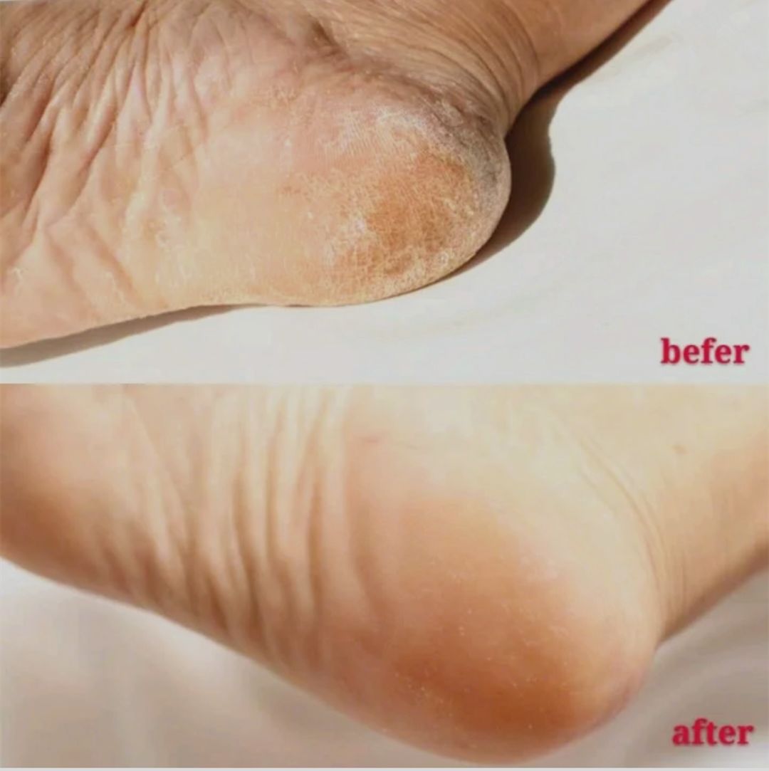 袜元素改善脚部烦恼的防臭抑菌袜,袜元素拯救脚臭的神器