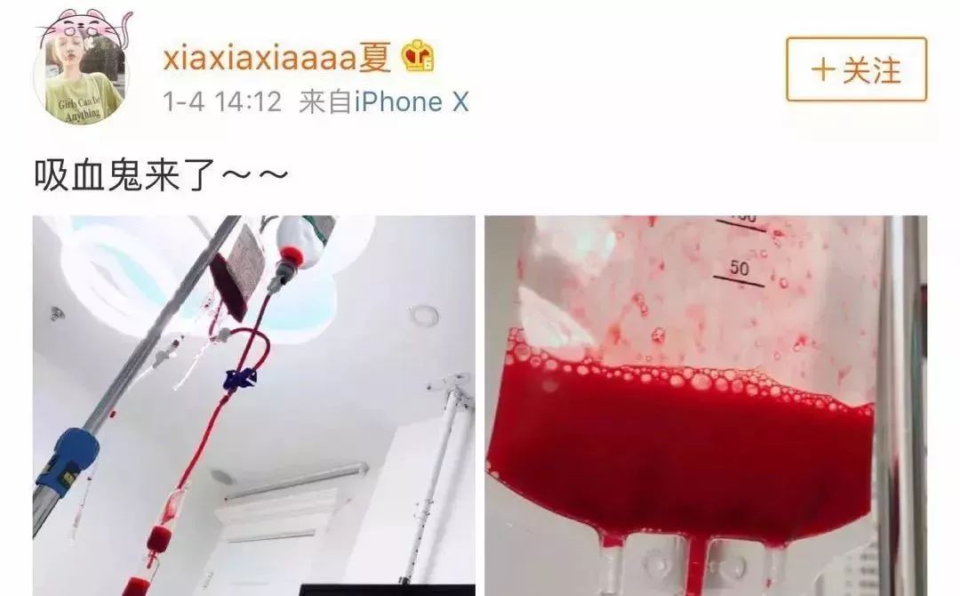 “洗血”疗法是什么鬼？减肥排毒还改善皮肤？这种医美太可怕……