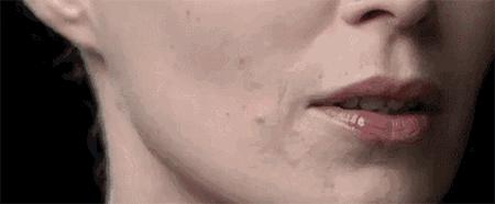 打近6万的美容针女子竟惨遭毁容,女子花4万打美容针没效果