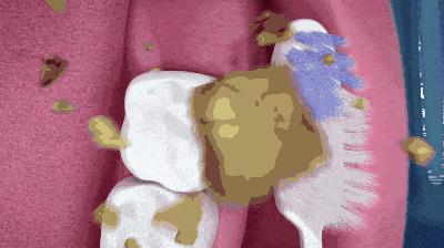 公认去牙黄最好的牙膏老爸评测,去牙渍去口气的牙膏测评