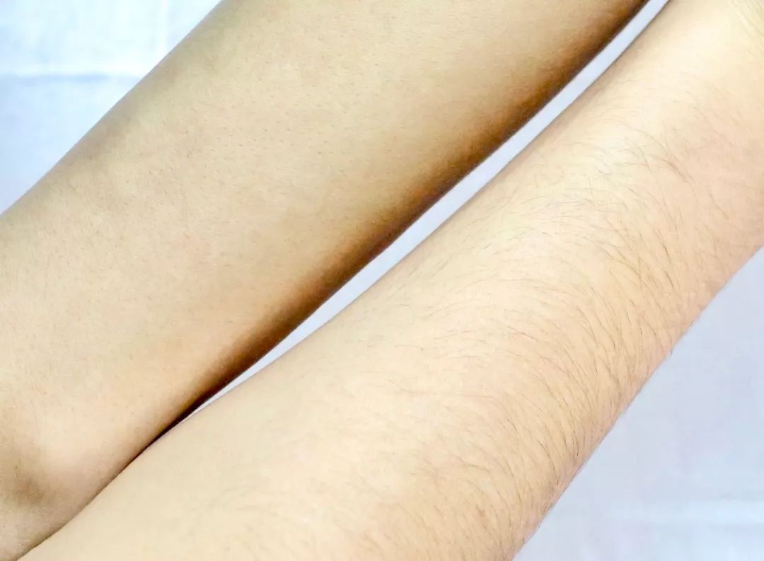 閫傚悎瀛︾敓鍏氱殑鍘昏吙姣涜啅,濂界敤鐨勮劚鍞囪劚姣涜啅鎺ㄨ崘