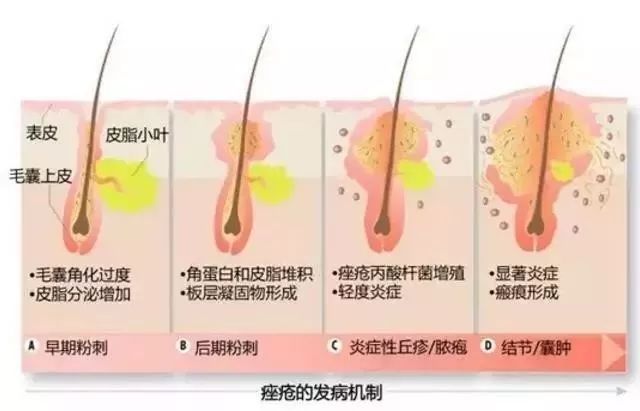 比luna还好用，价格只要1/10，这款洁面仪是魔鬼吗？