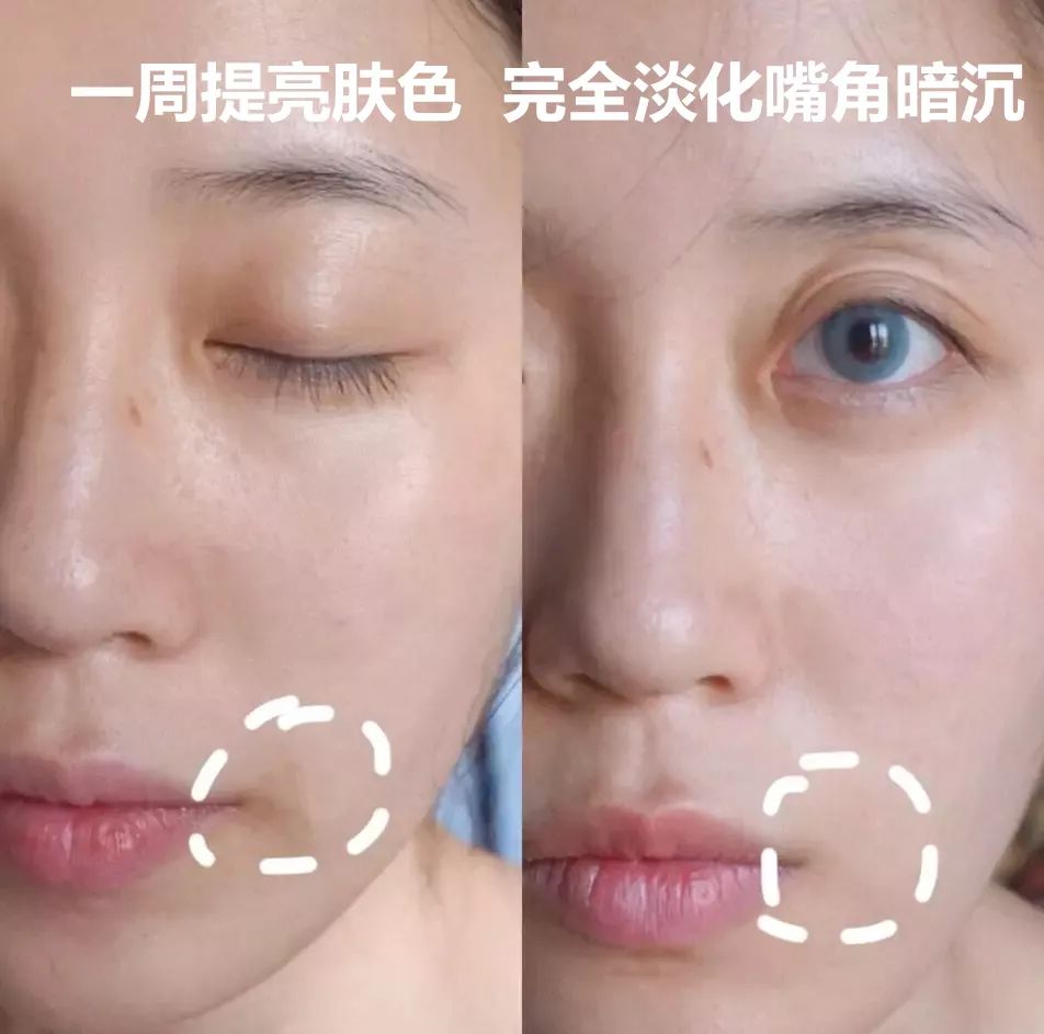 护肤小红书都在推荐的安瓶面膜,护肤补水推荐小红书