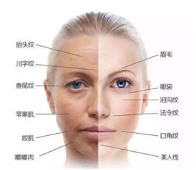 外用涂抹式肉毒素可以祛皱纹吗,去皱纹的肉毒素一年打几次为佳