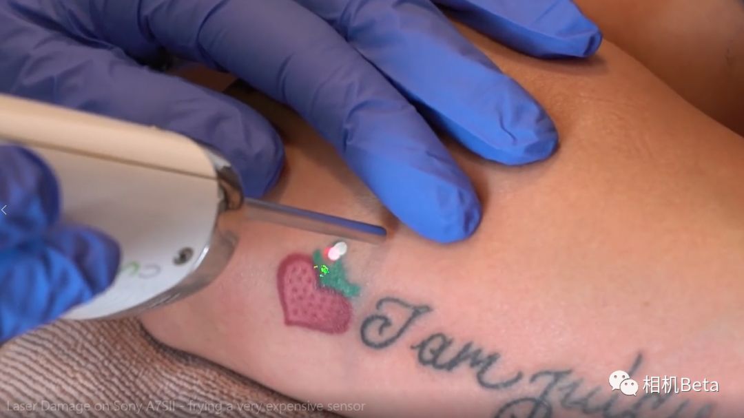 激光洗纹身真的不会留疤吗,索尼a7s2斑马纹