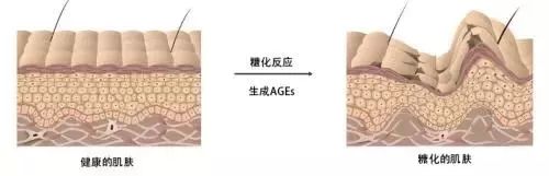 鍚冪硸闀跨棙鍙橀粦,鍚冪硸鍙橀粦闀跨棙