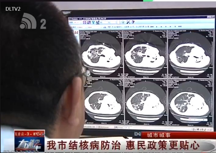 结核病防控有关制度,卫健委10条便民惠民举措