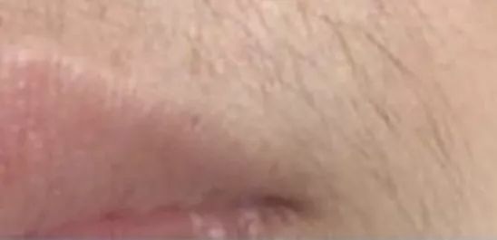 姑娘，我看你双目涣散、唇周长毛、乳晕发黑......