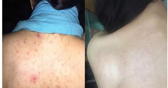 【3折抄底】身体清洁专场:进口、大牌、低至9.9包邮。喜欢干净漂亮的你~