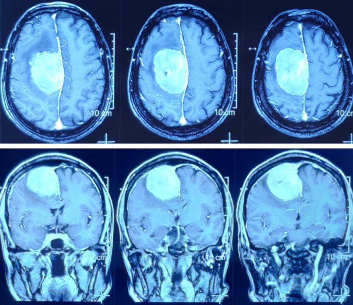 闫长祥医生,三博医院神经外科专家闫长祥