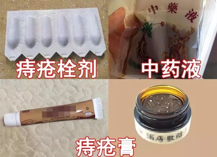 80%的痔疮无需手术治疗吗,痔疮又犯了用这个方法轻松治痔疮