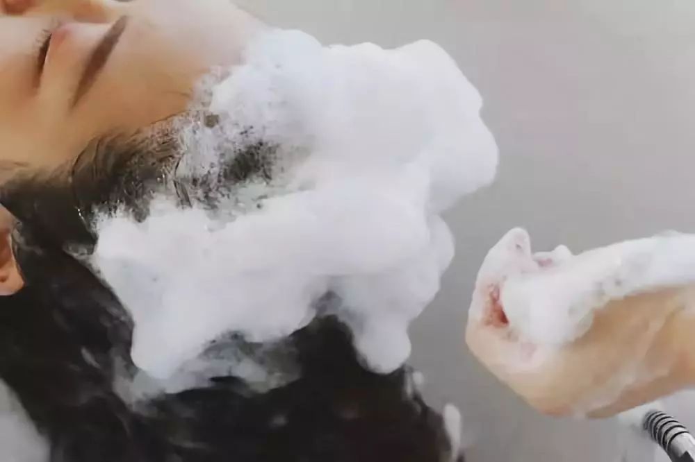 头皮屑多怎么办教你一招解决,头皮屑多怎么办教你一招