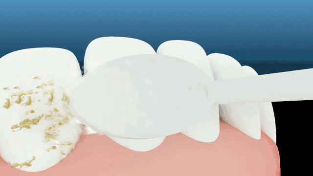 俄罗斯牙膏去黄牙怎么样,祛牙垢黄牙的牙膏国货之光