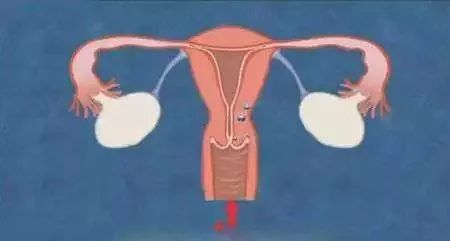 泗阳免费筛查两癌时间,农村免费妇女两癌筛查宣传