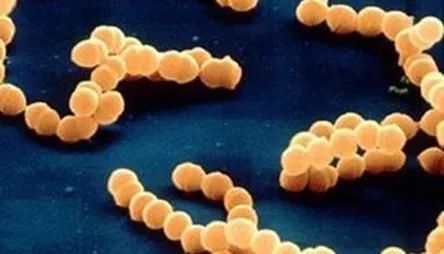 战痘神器祛痘效果怎么样,战痘神器推荐