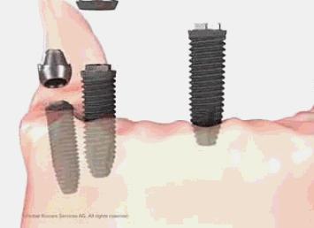 身份证36开头32结尾,身份证开头3756