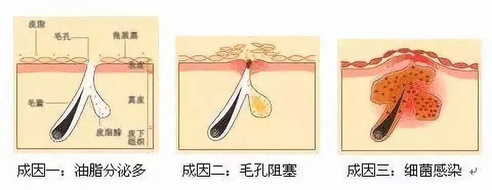 灏忚寕鑲岃瘖瀹ゅ埌搴曟湁澶氬己,灏忚寕鑲岃瘖瀹よˉ姘村悧