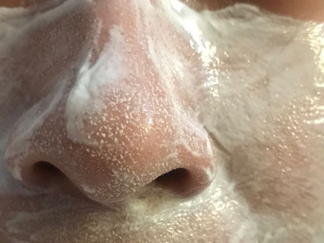 吹爆这个“超级面膜”，烂脸竟能一夜回春？