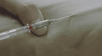 胳膊上的疤痕是怎样形成的,手臂上哪里的疤不容易被发现