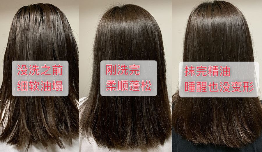 发根油发丝干枯怎么办,发根干枯毛躁油腻脱发