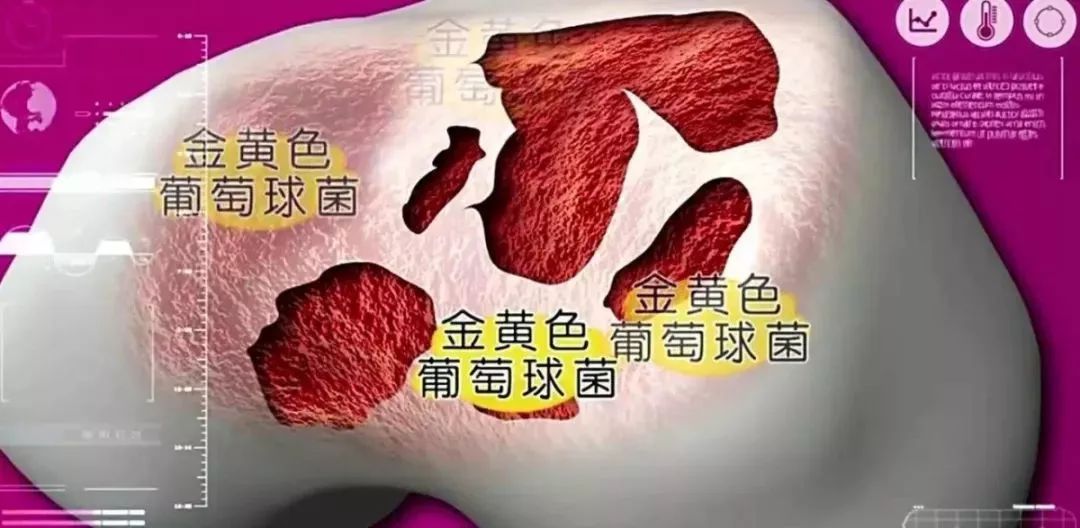 脚膝盖关节咔咔响什么原因引起的,一动身体各个关节咔咔响怎么回事